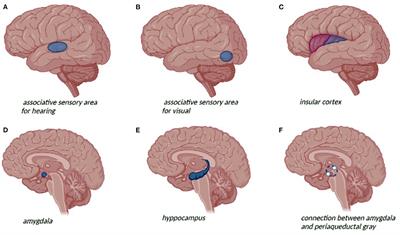 Temporal Lobe Epilepsy and Psychiatric Comorbidity